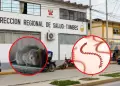Tumbes: Incrementa a 135 los casos confirmados de leptospirosis y se reportan dos fallecidos