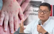 Lima registra 20 casos de ni�os infectados con el virus Coxsackie, seg�n Minedu