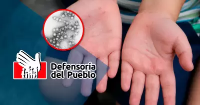 El organismo pide tomar medidas c�leres para atender los casos en aumento.