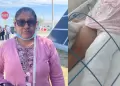 Tacna: Madre pide apoyo para menor atropellada en calle Zela y denuncia falta de responsabilidad