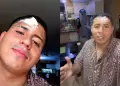 Conocido streamer fue agredido en discoteca y termin� con un corte en la frente: �Qu� pas�?