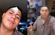 Conocido streamer fue agredido en discoteca y termin� con un corte en la frente: �Qu� pas�?