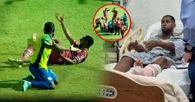 El jugador brasile�o estar� de baja entre 6 a 9 meses por terrible lesi�n.
