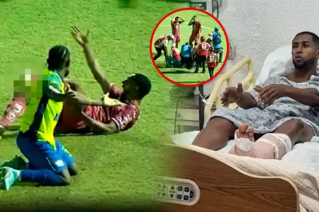 El jugador brasile�o estar� de baja entre 6 a 9 meses por terrible lesi�n.