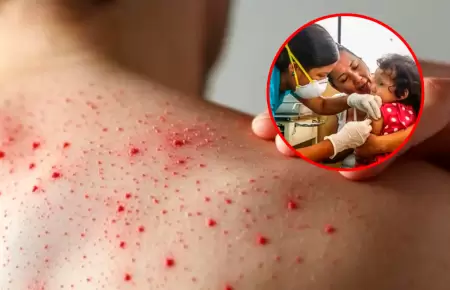 Brote de la enfermedad se dispara tras pocas semana de los primeros reportes.