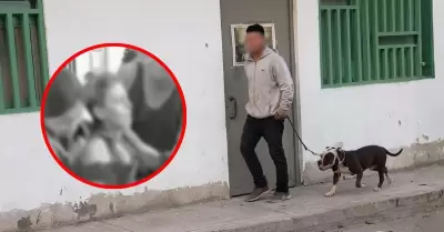Pitbull ataca a mujer y deja fuertes lesiones