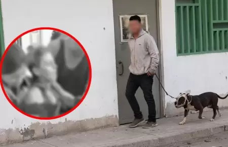 Pitbull ataca a mujer y deja fuertes lesiones