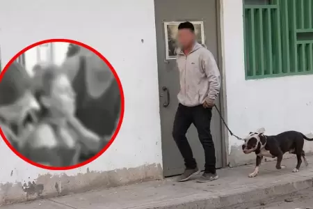 Pitbull ataca a mujer y deja fuertes lesiones