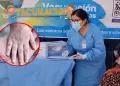Confirman tercer caso de sarampi�n en Lambayeque y refuerzan cerco epidemiol�gico: Se trata de un ni�o de 5 a�os