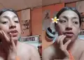 Mujer revela que termin� con su novio porque no quiso donarle un ri��n: "Me di cuenta que no me amaba"