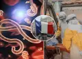 Francia confirma su primer caso positivo de �bola: Un m�dico que retorn� de la Rep�blica Democr�tica del Congo