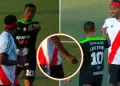 Jugador entr� al campo con una aguja en la mano durante un partido de la Copa Per�