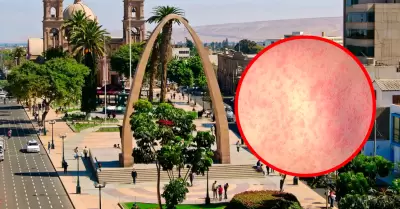 Casos de sarampi�n en Tacna