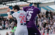 Jairo V�lez muestra c�mo qued� su rostro tras el codazo que, para Alianza Lima, debi� ser penal