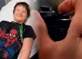 Ni�o quiso convertirse en Spider-Man al dejarse picar por una ara�a y termin� hospitalizado