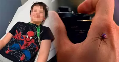 Ni�o se dej� picar por ara�a.