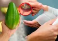 La "mano de palta": �Qu� es y por qu� un hospital de Alemania advierte del aumento de casos?