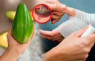La "mano de palta": ¿Qué es y por qué un hospital de Alemania advierte del aumento de casos?