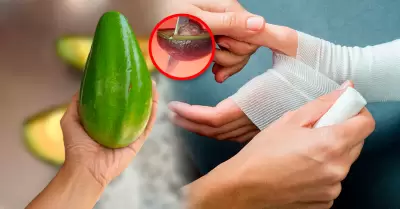 Lesiones se producen por t�cnicas incorrectas en la apertura del fruto.
