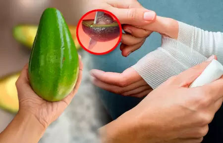 Lesiones se producen por t�cnicas incorrectas en la apertura del fruto.