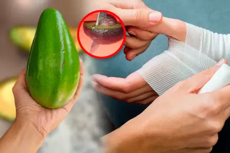 Lesiones se producen por t�cnicas incorrectas en la apertura del fruto.