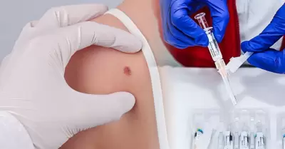 La vacuna logr� resultados positivos.