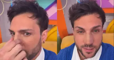 Nicola Porcella se somete a retoque en la nariz y muestra su nuevo perfil
