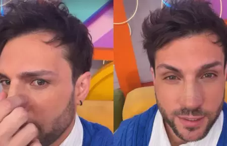 Nicola Porcella se somete a retoque en la nariz y muestra su nuevo perfil