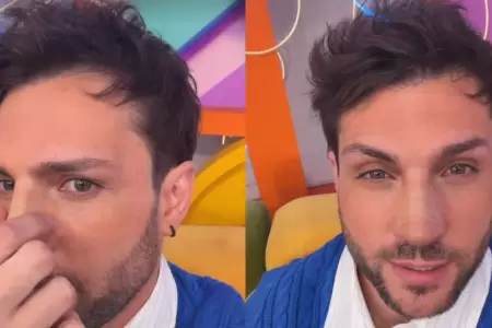 Nicola Porcella se somete a retoque en la nariz y muestra su nuevo perfil