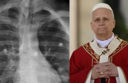 Papa Le�n XIV ser� hospitalizado este martes