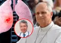 Papa Le�n XIV podr� realizar su gira por Latinoam�rica tras un descanso de 5 a 7 d�as luego de operaci�n, afirma neum�logo