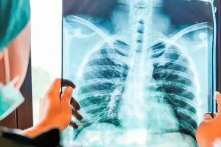 Diagnostican un adenocarcinoma pulmonar al papa Le�n XIV