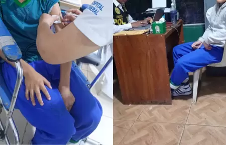 Escolar fue agredido por compa�ero en Hu�nuco y termin� con puntos en la cabeza