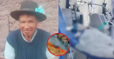 Adulto mayor con quemaduras requiere traslado a Lima