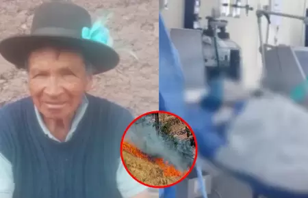 Adulto mayor con quemaduras requiere traslado a Lima