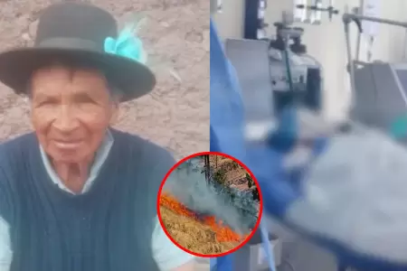 Adulto mayor con quemaduras requiere traslado a Lima