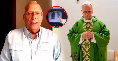 Hermano del pont�fice asegura que se recupera r�pidamente.