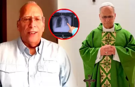 Hermano del pont�fice asegura que se recupera r�pidamente.