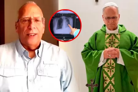 Hermano del pont�fice asegura que se recupera r�pidamente.