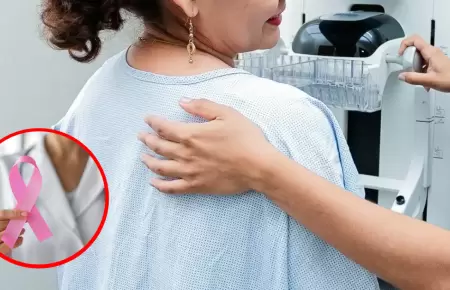 C�ncer de mama en Per�