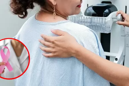 C�ncer de mama en Per�