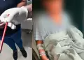 Comas: escolar fue operado tres veces tras sufrir perforaci�n intestinal por un l�piz en colegio