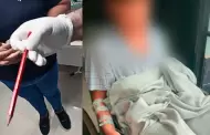 Comas: escolar fue operado tres veces tras sufrir perforaci�n intestinal por un l�piz en colegio