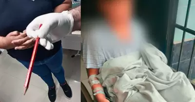 Escolar fue operado tres veces tras incidente.