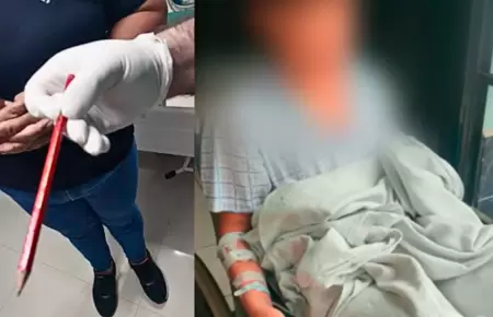 Escolar fue operado tres veces tras incidente.
