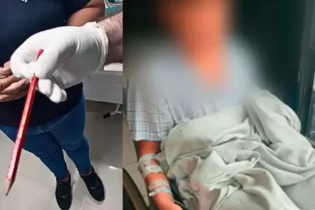Escolar fue operado tres veces tras incidente.
